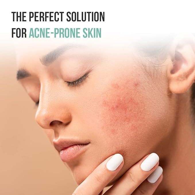 Furr%20By%20Pee%20Safe%202%25%20Salicylic%20Acid%20&%20Green%20Tea%20Anti%20Acne%20Face%20Wash%20-%20100Ml%20-%20Image%206