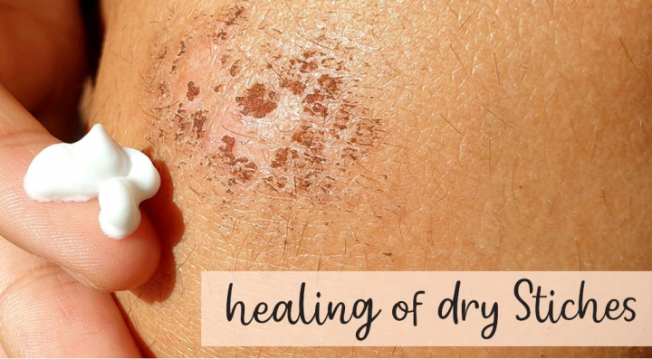 BOROLINE%20Antiseptic%20Cream,%20100gm,%20Night%20Repair%20Cream%20-%20Image%203