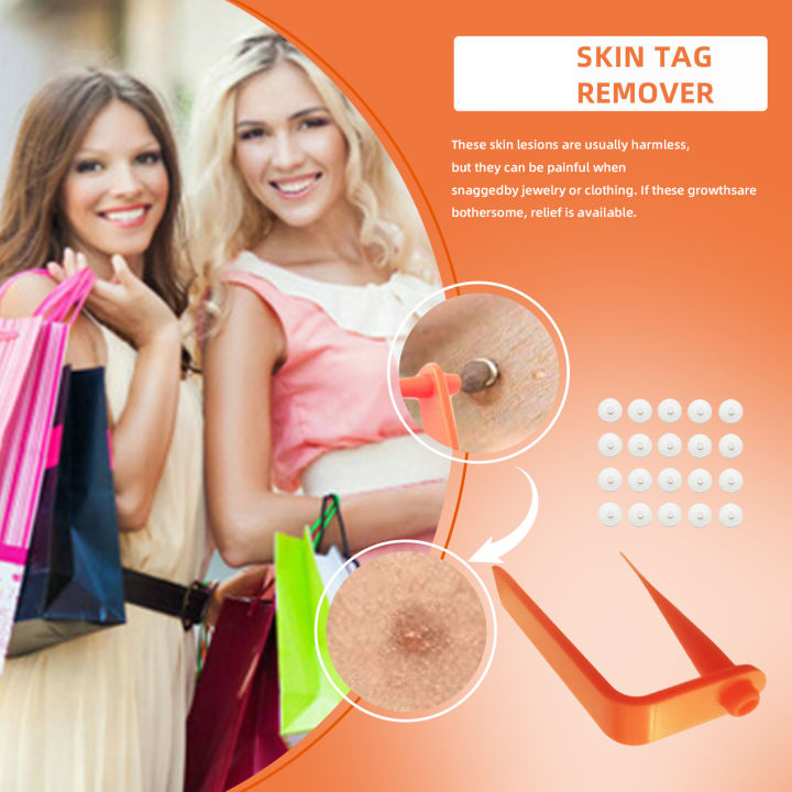 Painless%20Safe%20Skin%20Tag%20Remove%20Device%20Kit%20Micro%20Tags%20Sized(2mm%20to%204mm)%20Warts%20Remover%20Original%20Skin%20Band%20Tool%20Set%20-%20Image%206