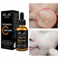 Pie Mei Vitamin C Serum For Freckle And Spots - 30ml E Bazzar. 