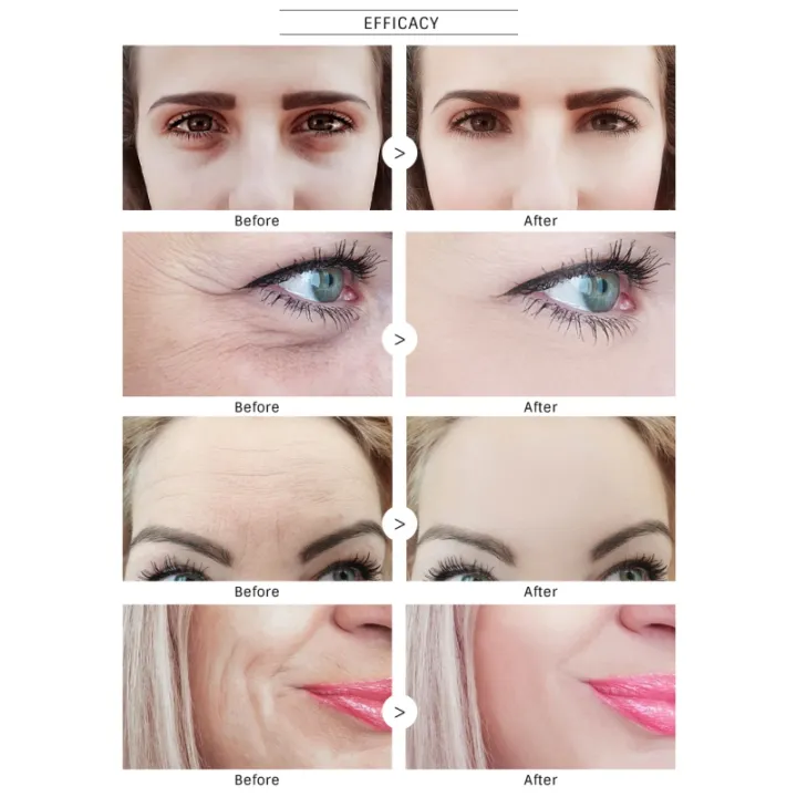 Dr.%20Rashel%2024K%20Gold%20Serum%20Pure%20Gold%2099.9%25%20All%20In%20One%20Face%20Serum%20(50ml)%20-%20Image%203