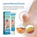 4pcs Lipoma Removal Cream – Herbal Natural Fat Lump Treatment | Sebaceous Cyst, Fibroma, Skin Lump, Fatty Tumor, Muscle Knot Removal Ointment – 20g. 