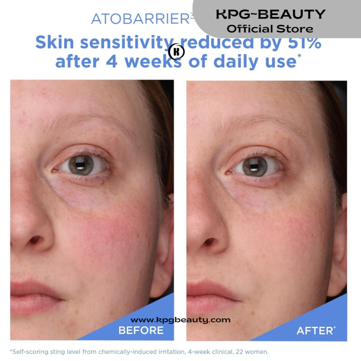 AESTURA%20ATOBARRIER365%20Cream%20with%20Ceramides,%20Korean%20Face%20Moisturizer%20for%20Barrier%20Repair%20%7C%20120H%20lasting%20Hydration,%20Ceramide%20Capsules,%20Dry%20&%20Sensitive%20Skin,%20Non-comedogenic,%2080%20mL%20KPG%20BEAUTY%20-%20Image%206