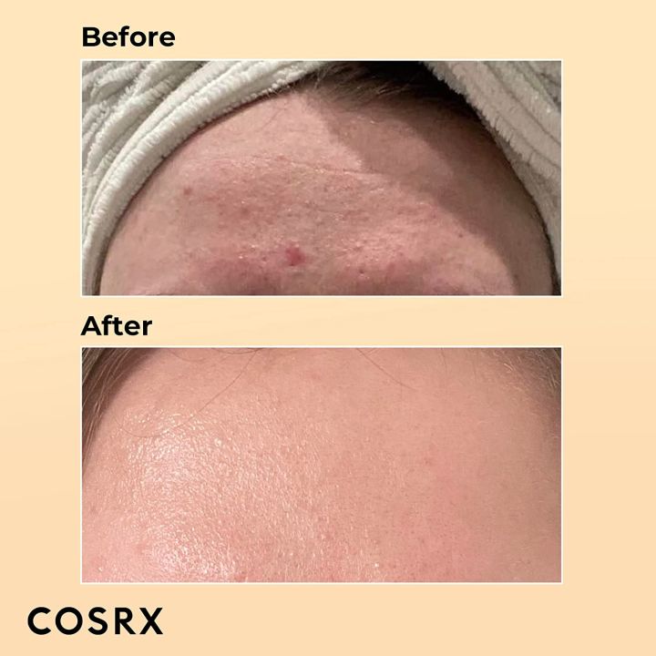Cosrx%20Advanced%20Snail%2096%20Mucin%20Power%20Essence%20Face%20Serum%20100ml%20%7C%20Korean%20Skincare%20-%20Image%203