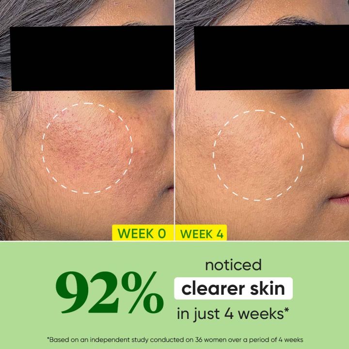 Dot%20&%20Key%20Cica%20Calming%20Oil%20Free%20Moisturizer%20for%20Acne%20Prone%20Skin%2060g%20-%20Image%203