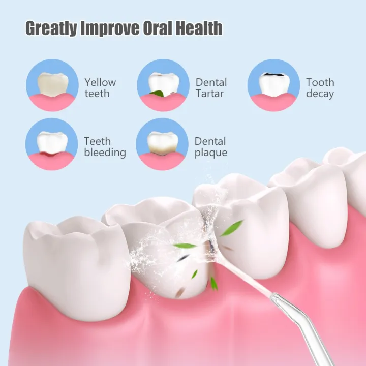200ml%20Premium%20Dental%20Flosser%20%7C%20IPX7%20Portable%20Oral%20Irrigator%20%7C%203%20Speed%20Level%20(Soft,%20Normal%20&%20Pulse)%20%7C%20Electric%20Water%20Flosser%20%7C%20Irrigator%20%7C%20Dental%20Water%20Floss%20for%20Teeth%20Braces%20&%20Orthodontic%20Teeth%20%7C%20Electric%20Brush%20Alternative%20for%20Teeth%20Whitening%20&%20Deep%20Floss%20-%20Image%207