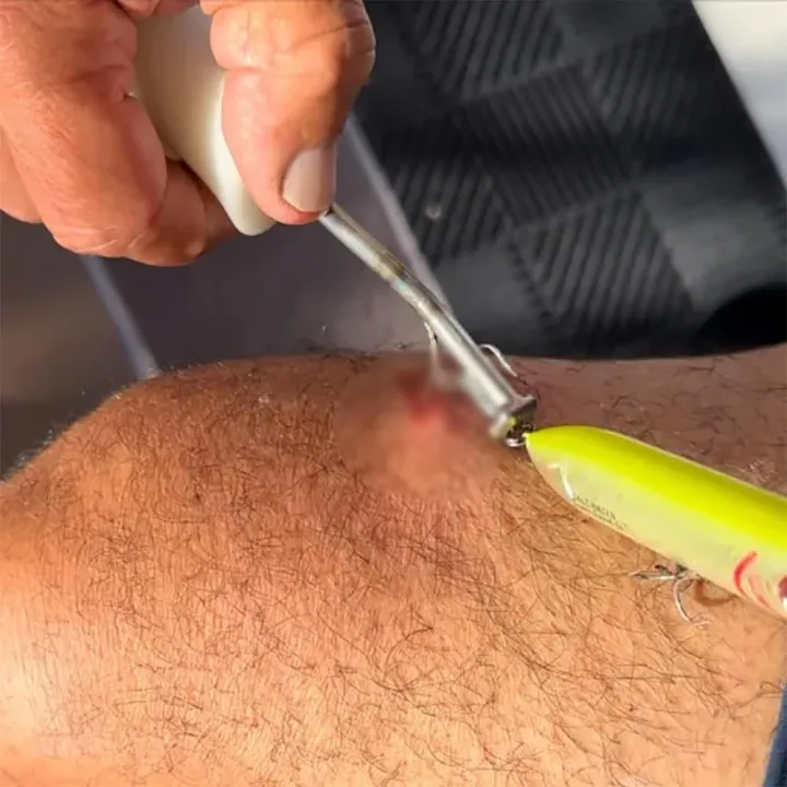 Portable%20Quick%20Release%20Fishhook%20Extractor%20with%20Handle%20Non-slip%20Fish%20Hook%20Remover%20Security%20Extractor%20Fishhook%20Disconnect%20Removal%20Tool%20Outddor%20-%20Image%203