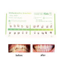 20Pcs/Pack Dental Orthodontic Metal Braces Bracket Mini Roth/MBT/Edgewise 022 Slot Dentist Bracket Dental Metal Bracket. 