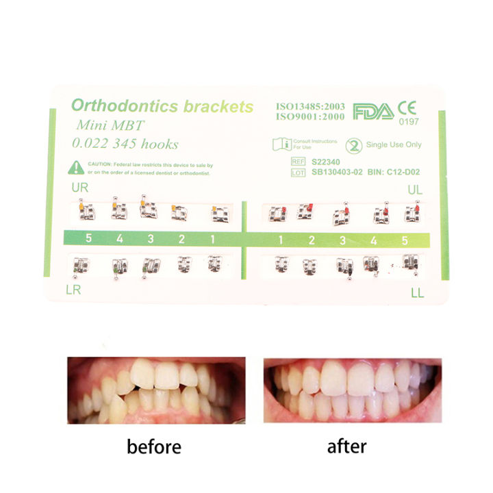 20Pcs/Pack%20Dental%20Orthodontic%20Metal%20Braces%20Bracket%20Mini%20Roth/MBT/Edgewise%20022%20Slot%20Dentist%20Bracket%20Dental%20Metal%20Bracket%20-%20Image%202