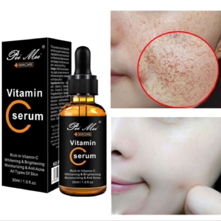 Pei%20Mei%20Vitamin%20C%20Moisturizing%20&%20Anti-Acne%20Face%20Serum%20-%2030ml%20-%20Image%204