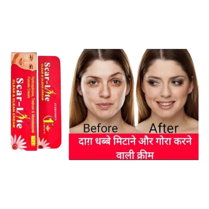 Blemishes%20Night%20Cream%20Skin%20Lite%20Cream%2015g%20-%20Image%203