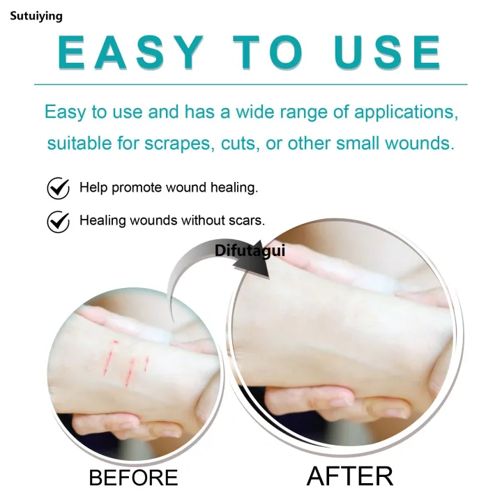 Difutagui%20Liquid%20Bandage%20Drops;%20Liquid%20Wound%20Suture;%20Wound%20Glue,%20Profesional%202025%20Reduce%20And%20Isolate%20,%20Waterproof%20And%20Breathable%2030ml%20-%20Image%206