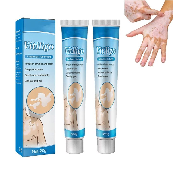NUTRIG Vitiligo Treatment Cream for White Spots, Vitiligo Cream Treatment Ointment Leucoplia Relief Repair Melanin/20g
