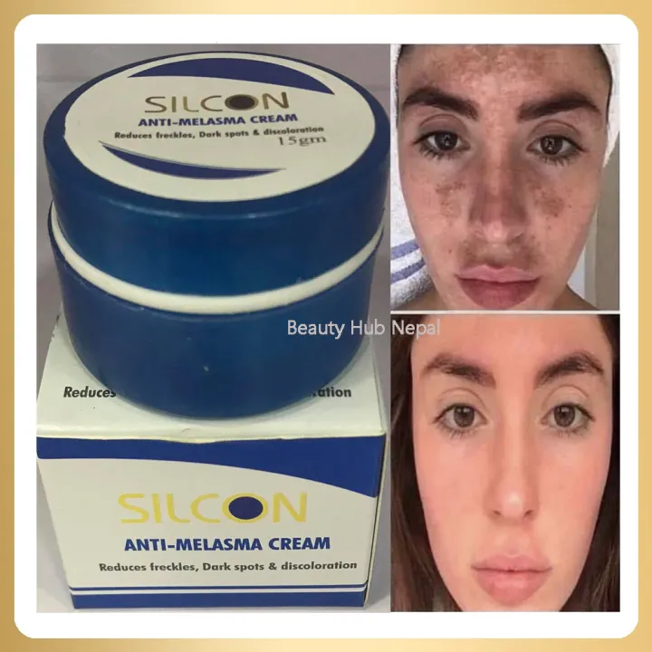 Silcon%20Anti%20Melasma%20Cream%2015gm%20-%20Image%205