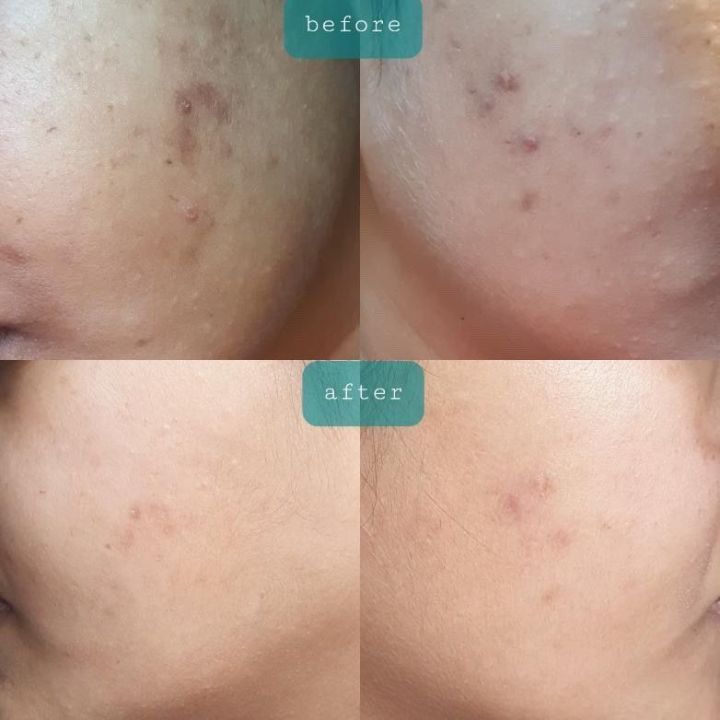 COLLAGEN%20Facial%20Serum%20With%20Hyaluronic%20Acid%20and%20Multivitamins%20-%2030ml%20-%20Image%206