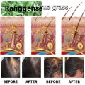 Ranggense Australian Mancao Shampoo Usma Hair Oil Prevents Hair Loss Nourishes Improves Sparse Hair Relieves Itching and Controls Oil. 