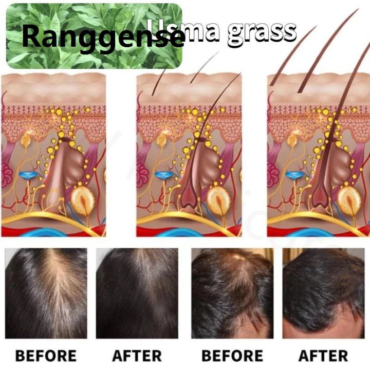 Ranggense%20Australian%20Mancao%20Shampoo%20Usma%20Hair%20Oil%20Prevents%20Hair%20Loss%20Nourishes%20Improves%20Sparse%20Hair%20Relieves%20Itching%20and%20Controls%20Oil%20-%20Image%204