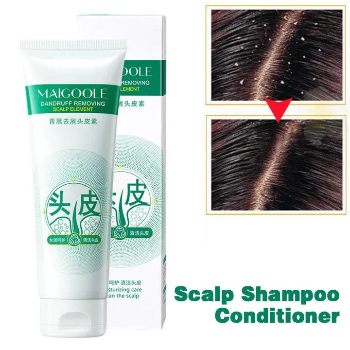 Maigoole%20Scalp%20Shampoo%20Scalp%20Shampoo%20Conditioner%20Deep%20Cleaning%20Scalp%20Refreshing%20Control%20Oil%20For%20Men%20Women%20W3c5%20-%20Image%204