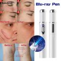 Sutuiying Blue Light Therapy Acne Laser Pen LED Face Light Therapy For Scar Original Wrinkle Removal Treatment Device Skin Care Beauty Equipment. 