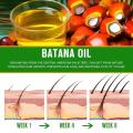 2025 NEW Smoothness and 100% natural growth of male oil bata hair used for hair growth can prevent and increase hair thickness in women with hair loss. 