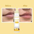 WishCare Ceramide Lip Balm with SPF50 PA+++ - Kojic Acid & Niacinamide - For Lip Lightening & Protection 5gm. 