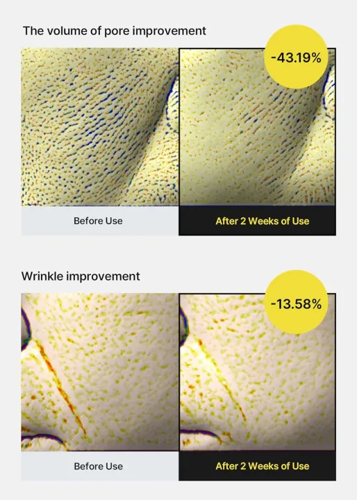 Celimax%20The%20Vita%20A%20Retinal%20Shot%20Tightening%20Serum%20%7C%20with%20Pure%20Vitamin%20A%20Retinol,%20Peptide,%20Pore%20Minimizer,%20Wrinkles%20&%20Fine%20Lines,%20Firmer%20Skin,%20Anti-Aging,%20Skin%20Smoothing%2030ml%20-%20Image%204