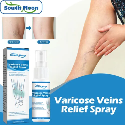 South%20Moon%20Varicose%20Veins%20Spray%20-%2030ml%20-%20Image%204