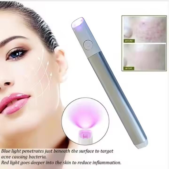 Laser%20Acne%20Therapy%20Device%20%E2%80%93%20Portable%20Red%20&%20Blue%20Light%20Treatment%20for%20Acne,%20Blemishes%20&%20Skin%20Rejuvenation,%20Safe%20for%20Face%20&%20Body,%20Adjustable%20Intensity%20-%20Image%202