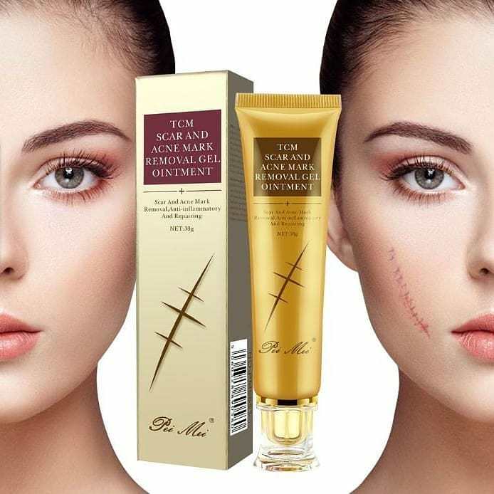 TCM%20Scar%20and%20Acne%20Marks%20Removal%20Gel,%20Scars,%20Burns,%20Stretch%20Marks,%20Acne%20Spots,%20Treatment%20Gel%20Ointment%20for%20Face%20and%20Body%2030g%20-%20Image%206