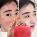 701 Collagen Plus Vitamin C & E Brightening Soap - Original  - Anti-Aging & Skin Firming Facial Soap - Dark Spot Remover & Glow Booster/Product Of Indonesia. 