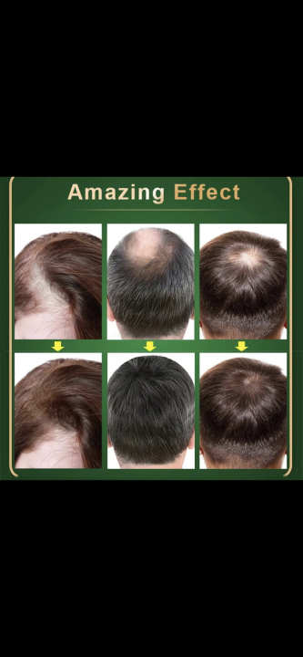 Green%20Wealth%20Neo%20Hair%20Lotion%20Original%20120%20ML%20-%20Image%207