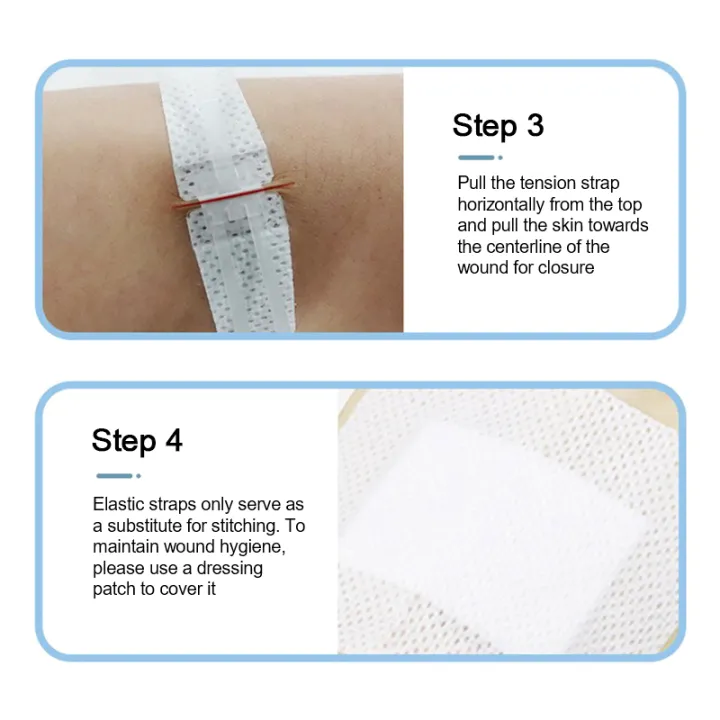Closure Patch Zipper Tie Wound Closure Patch Zipper Band-Aid Wound Fast Suture ...