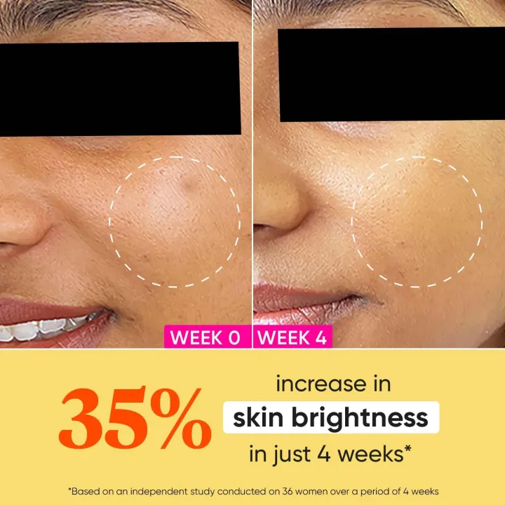 Dot%20&%20Key%20Vitamin%20C%20+%20E%20Sorbet%20Face%20Moisturizer%2060ml%20-%20Image%204