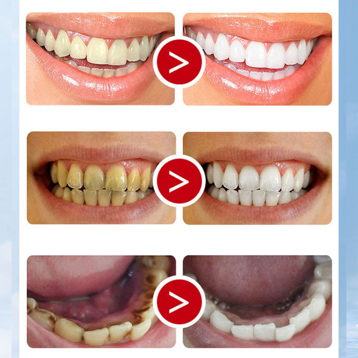 Dr.%20Zhuo's%20English%20version%20of%20dental%20separator%20spot%20fast%20generator,%20good%20supply%20of%20e-commerce%20wholesale%20support%20for%20dropshipping%20-%20Image%204