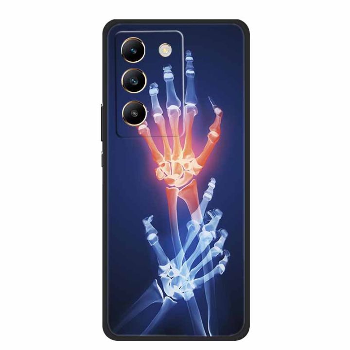 For%20Vivo%20Y200e%20Case%20Y%20200%20e%20Phone%20Cover%20Black%20Silicone%20Soft%20Phone%20Case%20For%20Vivo%20Y200e%20Back%20Cover%20Case%20Y%20200e%20Y200%20e%20Coque%206.67%20-%20Image%202