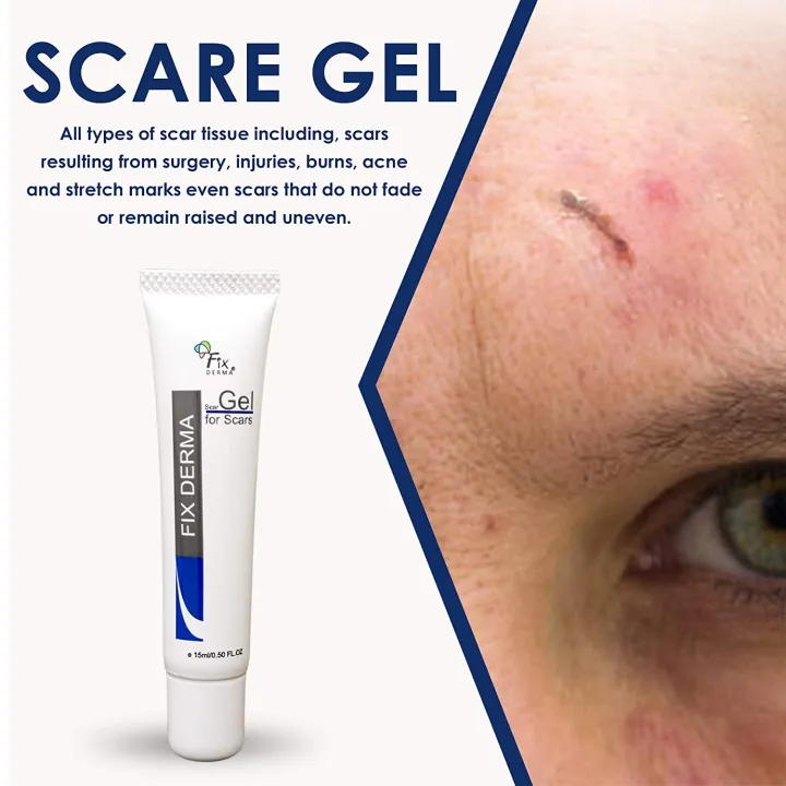 Scar%20Gel%20Fix%20Derma,%20Scar%20Removal%20Gel,%20For%20All%20Age%20Group,%2015Ml%20-%20Image%203