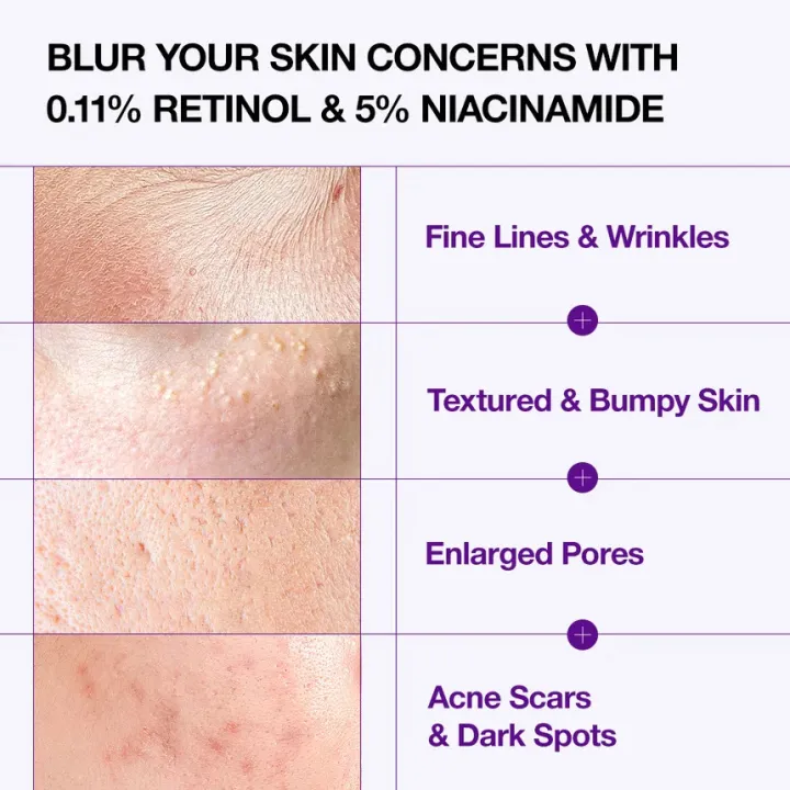 Anua%20Nano%20Retinol%200.3%25%20Niacin%20Renewing%20Serum%2030ml%20By%20koreanbeautypoint%20-%20Image%202