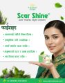 Scar Shine Cream 20gram National Herbs. 