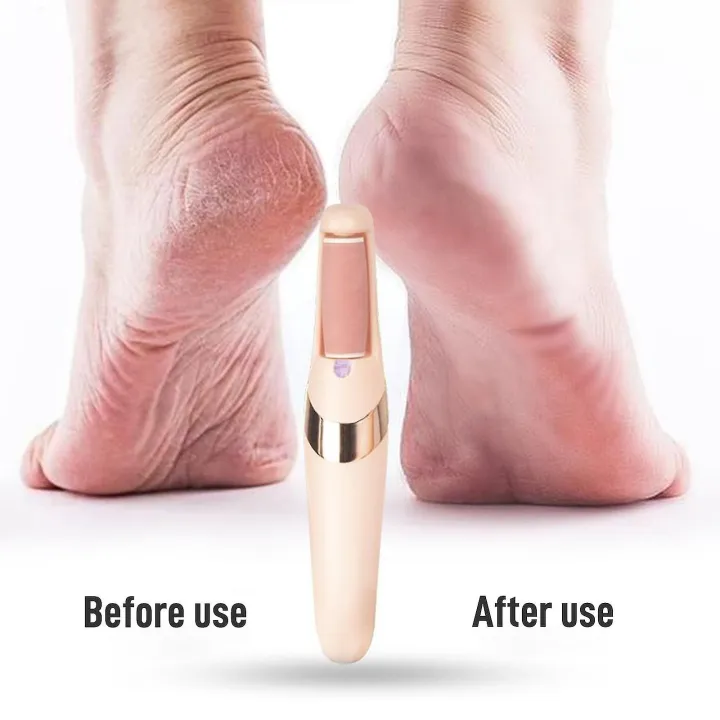 Flawless%20Electric%20Pedi%20Callus%20Remover%20-%20Image%204