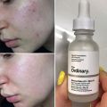 The Ordinary Niacinamide 10% + Zinc 1% Serum (30ml). 