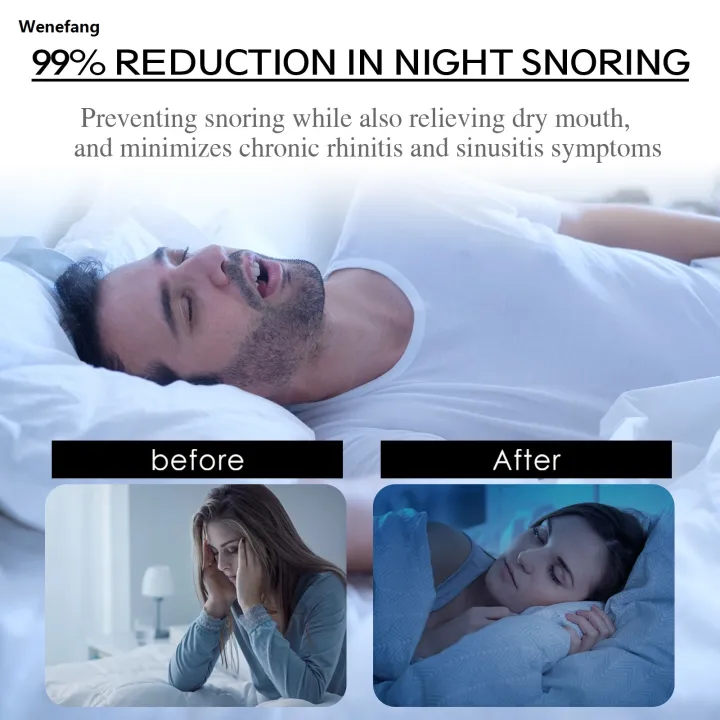 Wenefang%2030pcs/Bag%20Mouth%20Tape%20for%20Sleep%20Anti%20Snoring%20Mouth%20Strips%20Allergenic%20New%20style%20Medical%20Grade%20Nose%20Breathing%20Strips%20Reduce%20Mouth%20Dryness%20-%20Image%206