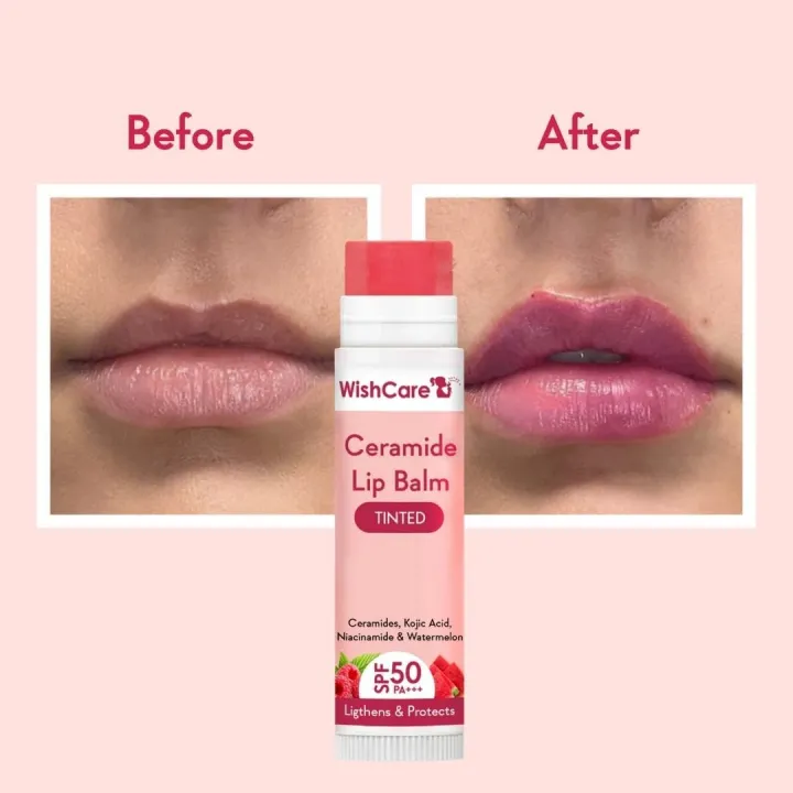 Wishcare%20Tinted%20Ceramide%20Lip%20Balm%20with%20SPF50%20PA+++%20-%20Kojic%20Acid%20&%20Niacinamide%20-%20For%20Lip%20Lightening%205g%20-%20Image%203