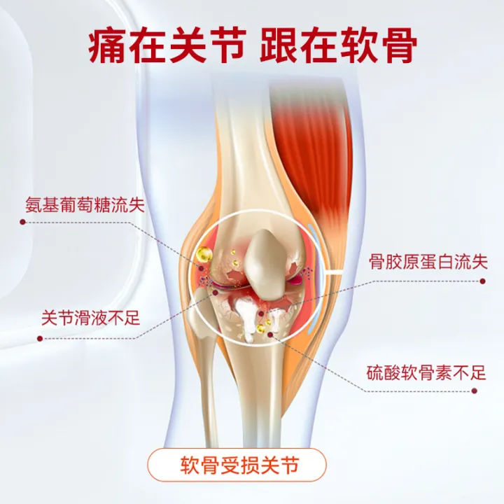 Small%20red%20tube%20aminochondroitin%20soothing%20ointment%20joint%20care%20ointment%20knee%20shoulder%20and%20neck%20external%20ammonia%20massage%20ointment%20-%20Image%203