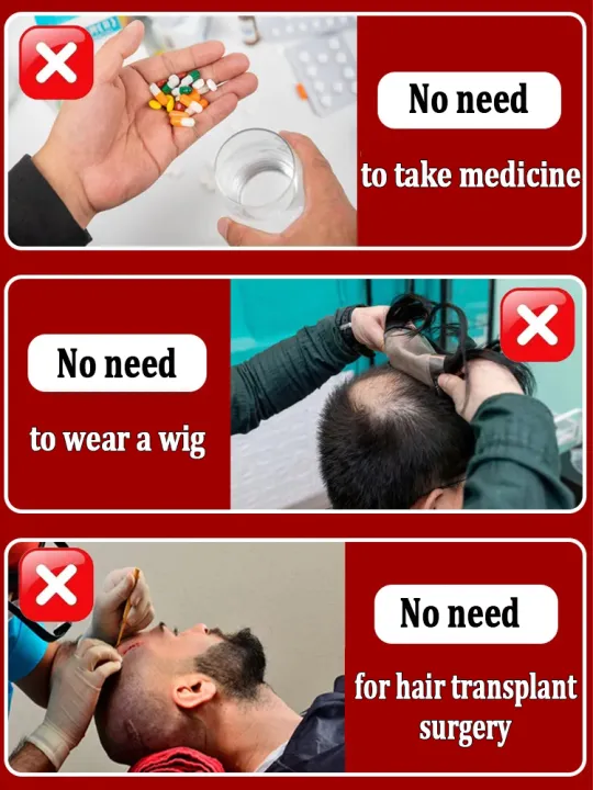 Hair%20growth%20essential%20oil,%20repair%20hair%20loss%20and%20baldness,%20restore%20thick%20hair%20-%20Image%205