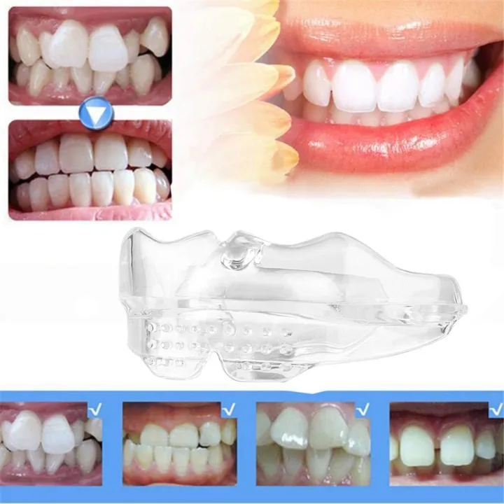 DealSpot%20Dental%20Orthodontic%20Teeth%20Corrector%20Braces%20%7C%20Removable%20Teeth%20Retainer%20&%20Alignment%20Trainer%20Tool%20%7C%20Reusable%20Dental%20Straightening%20Device%20for%20Oral%20Care,%20Smile%20Support%20(Adults%20&%20Teens)%20-%20Image%206