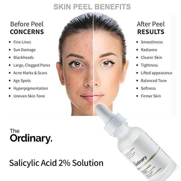 The%20Ordinary%20Salicylic%20Acid%202%25%20Solution%20Serum%20(30ml)%20-%20Image%203