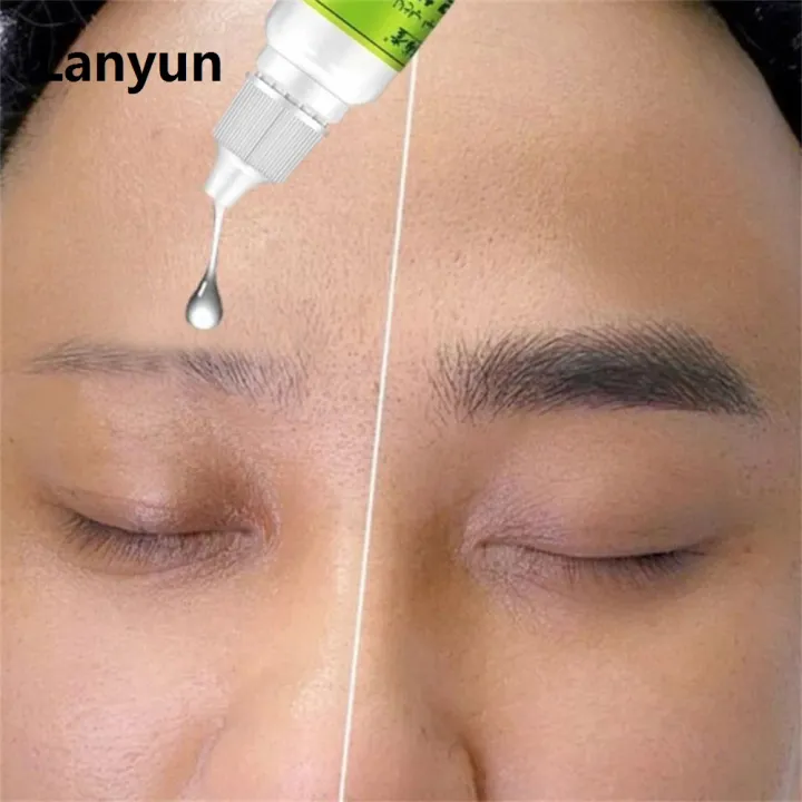 Lanyun%20Usma%20Grass%20Hair%20Care%20Cilia%20Growth%20Nourishing%20Liquid%20Extract%20Essences%20Fashion%20For%20Eyebrows%20Eyelashes%20Hairline%20Eyebrow%20Growth%2010ml%20-%20Image%206