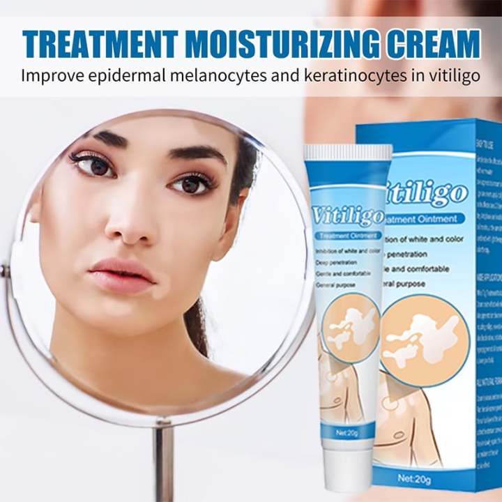 NUTRIG%20Vitiligo%20Treatment%20Cream%20for%20White%20Spots,%20Vitiligo%20Cream%20Treatment%20Ointment%20Leucoplia%20Relief%20Repair%20Melanin%2020g%20-%20Image%204