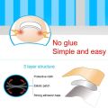 HOT Pexmen 6Pcs/Sheet Ingrown Toenail Correction Sticker Adhesive Toenail Patch Toe Nail Treatment Corrector Foot Care Tool. 