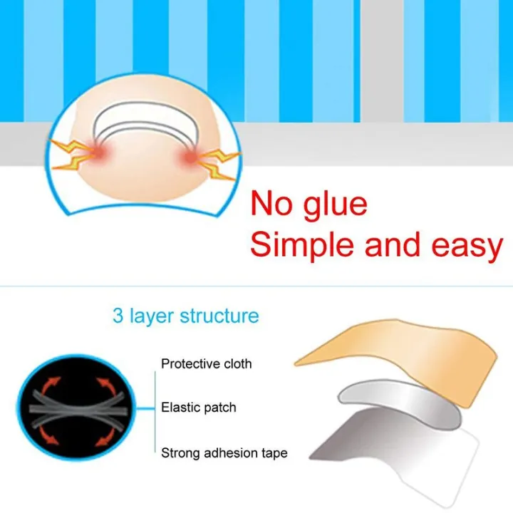 HOT%20Pexmen%206Pcs/Sheet%20Ingrown%20Toenail%20Correction%20Sticker%20Adhesive%20Toenail%20Patch%20Toe%20Nail%20Treatment%20Corrector%20Foot%20Care%20Tool%20-%20Image%204